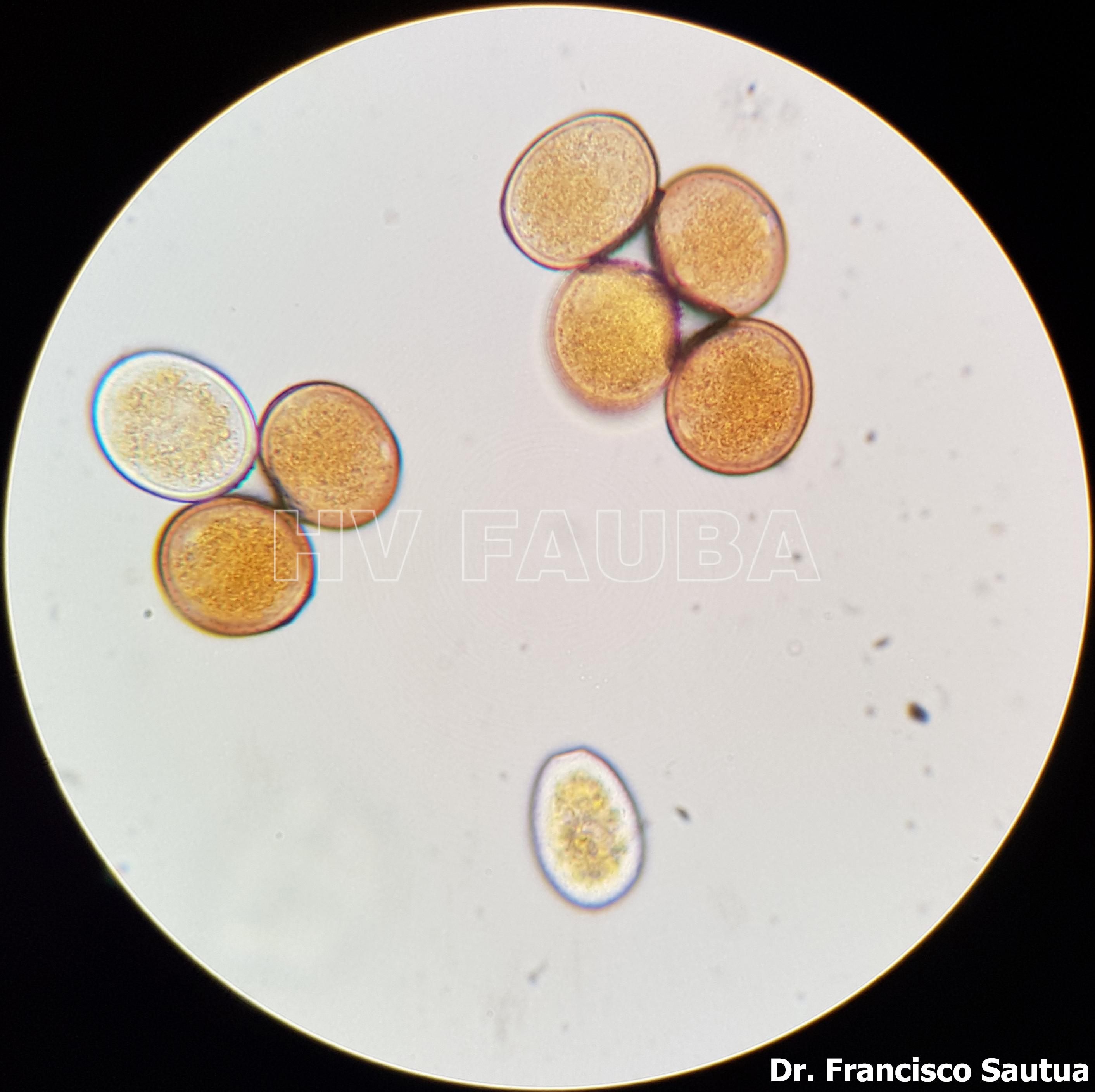 Uredosporas de Puccinia sorghi al microscopio óptico. Autor: Dr. Francisco Sautua