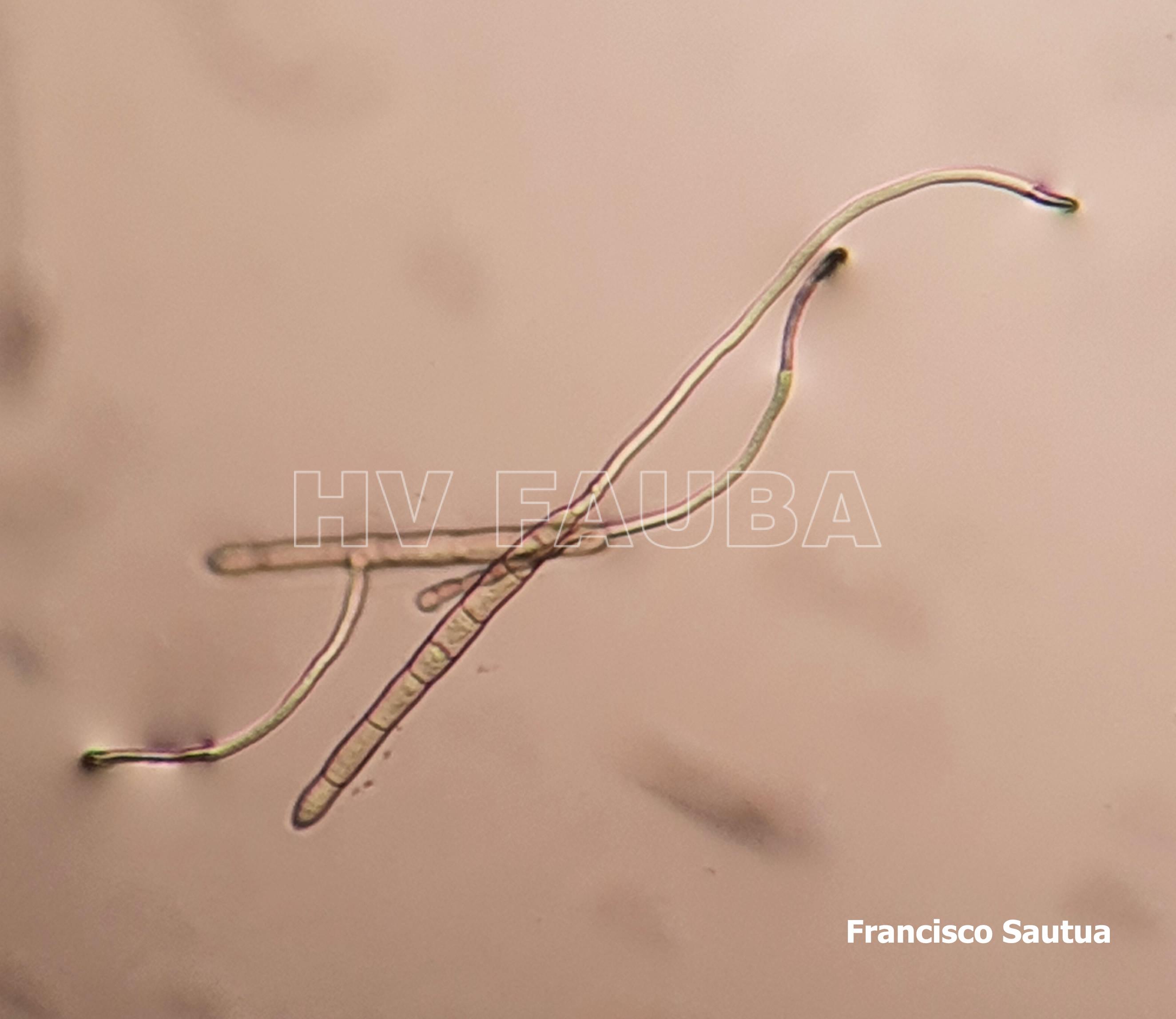 Conidios de Drechslera tritici-repentis germinados en agar agua. Autor: Francisco Sautua