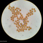 6 Uredinosporas de Roya anaranjada o de la hoja (Puccinia triticina Eriks)