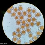 8 Uredinosporas de Roya anaranjada o de la hoja (Puccinia triticina Eriks)