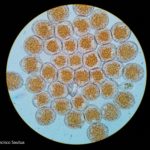 9 Uredinosporas de Roya anaranjada o de la hoja (Puccinia triticina Eriks)