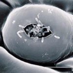 SEM (scanning electron microscope) de estomas en hoja de pomelo con bacterias Xanthomonas campestri pv. citri (Xcc) entrando en la cámara estomática. Autor: J. Cubero.