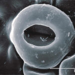 SEM (scanning electron microscope) de estomas en hoja de pomelo con bacterias Xanthomonas campestri pv. citri (Xcc) en la cámara estomática. Autor: J. Cubero.