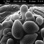 Imagen de microscopía electrónica de barrido (SEM) de un uredio (pústula) y urediosporas de Phakopsora pachyrhizi, agebte causal de la roya asiática de la soja. Autor: Zhi-Yuan Chen.