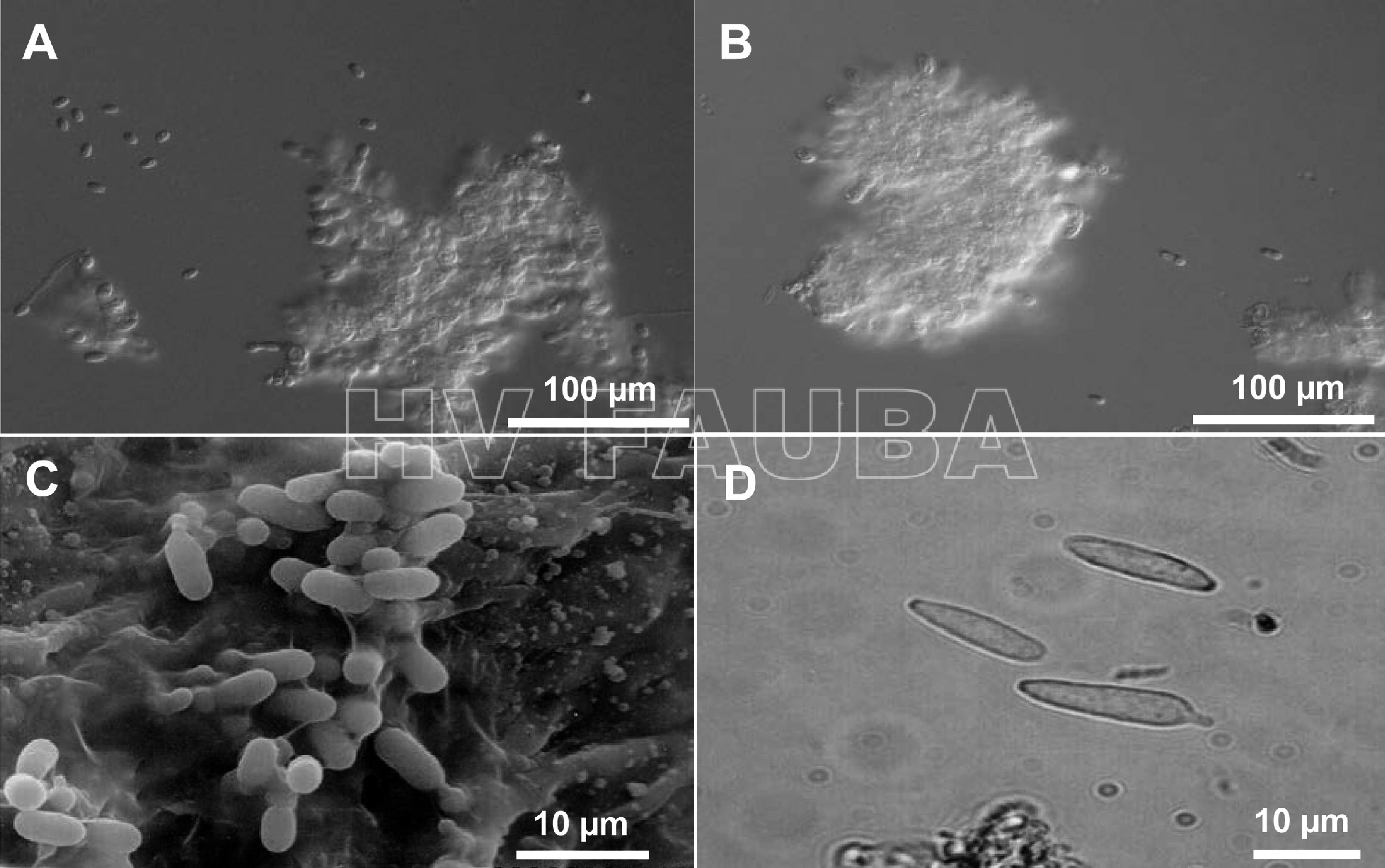Conidios de Elsinoe spp. (A, B) conidios hialinos de E. fawcettii y E. australis producidos en agua, respectivamente. (C) conidios hialinos en una lesión foliar de E. fawcettii observada al microscopio electrónico de barrido. (D) conidios fusiformes de E. fawcettii producidos sobre una lesión foliar. Autor: Hyun et al., 2015.