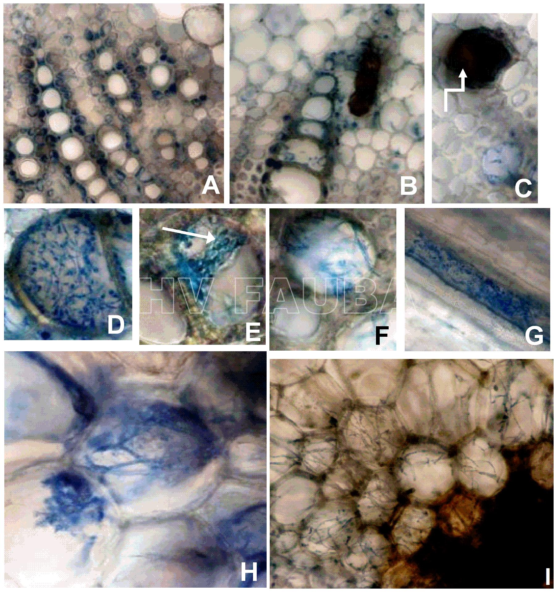 Infección patógena por aislados de tipo salvaje de los tipos A y B de Cadophora gregata f. sp. sojae observado en cortes transversales de tallos de un cultivar de soja susceptible (Corsoy 79), 8 semanas después de la inoculación. (A) No se observó infección en el control no inoculado. (B) Inoculado con el Tipo B. (C) Vaso necrótico sin estructuras fúngicas vistas en el interior. (D) Vaso fuertemente colonizado por C. gregata. (E) Un vaso con evidencia de esporulación (flecha). (F) Hifas de C. gregata que crecen entre los vasos, posiblemente causante de las ahuecamiento del tallo. (G) Una sección longitudinal del xilema infectado por C. gregata. (H y I) C. gregata comienza a colonizar las células del parénquima que forman la médula del tallo. Las imágenes A – G e I tienen 200x aumentos, H 400x aumentos. Autores: Impullitti & Malvick, 2014. doi: 10.1371 / journal.pone.0098311.g002