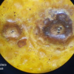 Síntomas de mancha negra sobre naranja. Se observan picnidios de Phyllosticta citricarpa en el centro de las manchas.