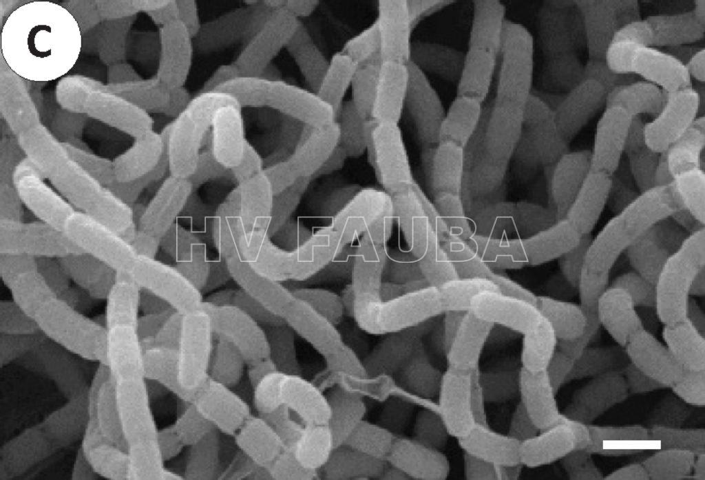 Micrografía electrónica de barrido (SEM) de Streptomyces scabiei. La bacteria produce hifas espirales y tabiques de esporulación con constricciones. La barra de escala representa 1 μm. Autor: Lin et al. 2018