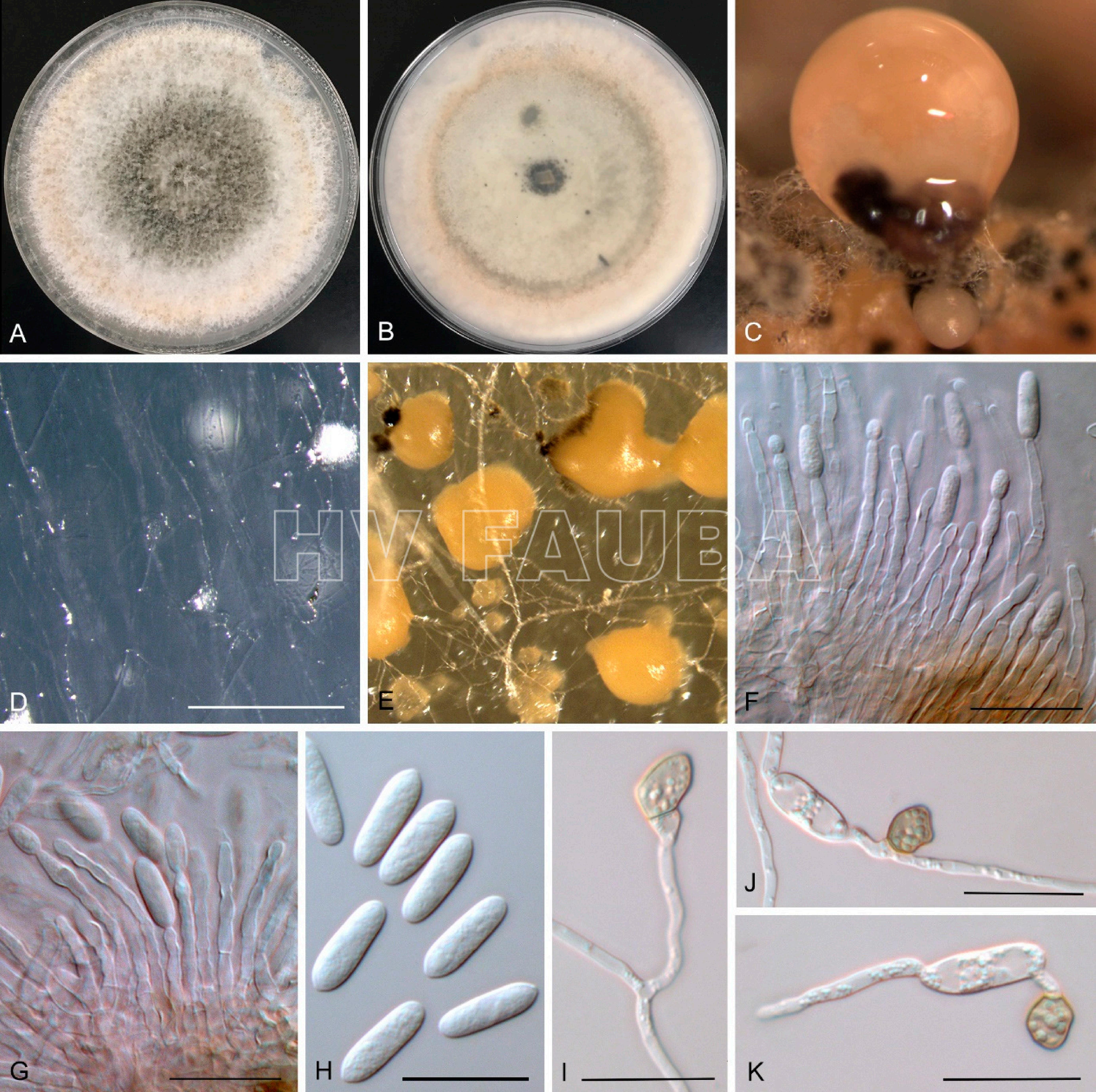 Características morfológicas de Colletotrichum australianum sp. nov .: Cultivo de una semana en PDA (A, B), conidiomas en cáscara de mandarina (C), conidiomas en SNA (D), conidiomas en PDA (E), conidióforos (F, G), conidios (H) y apresorios (I – K). Barras de escala: D, 500 µm; F, G, H, I, J, K, 20 µm. Autor: Wang et al 2021.