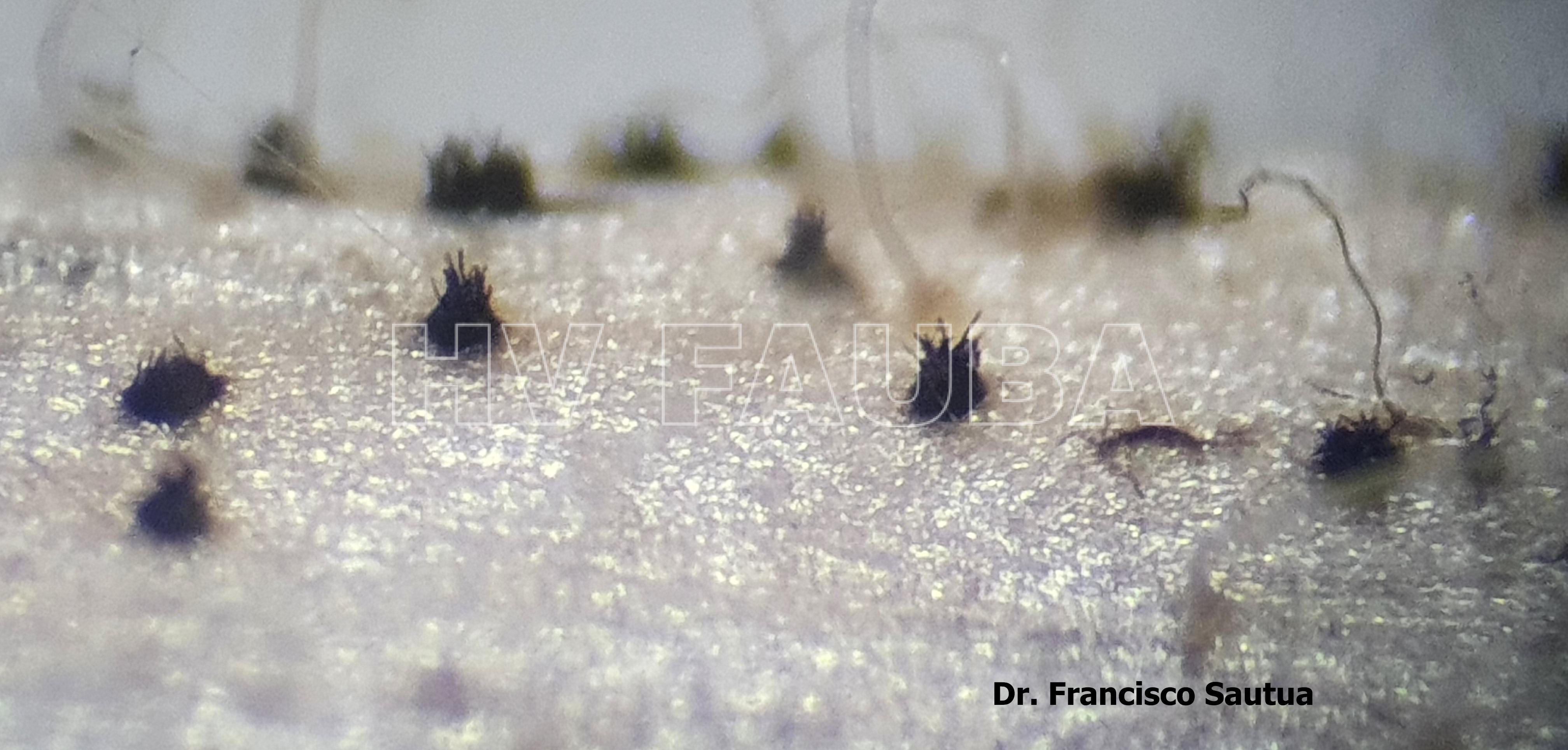 Acérvulas de Colletotrichum spp. sobre tallo de soja. Autor: Dr. Francisco Sautua