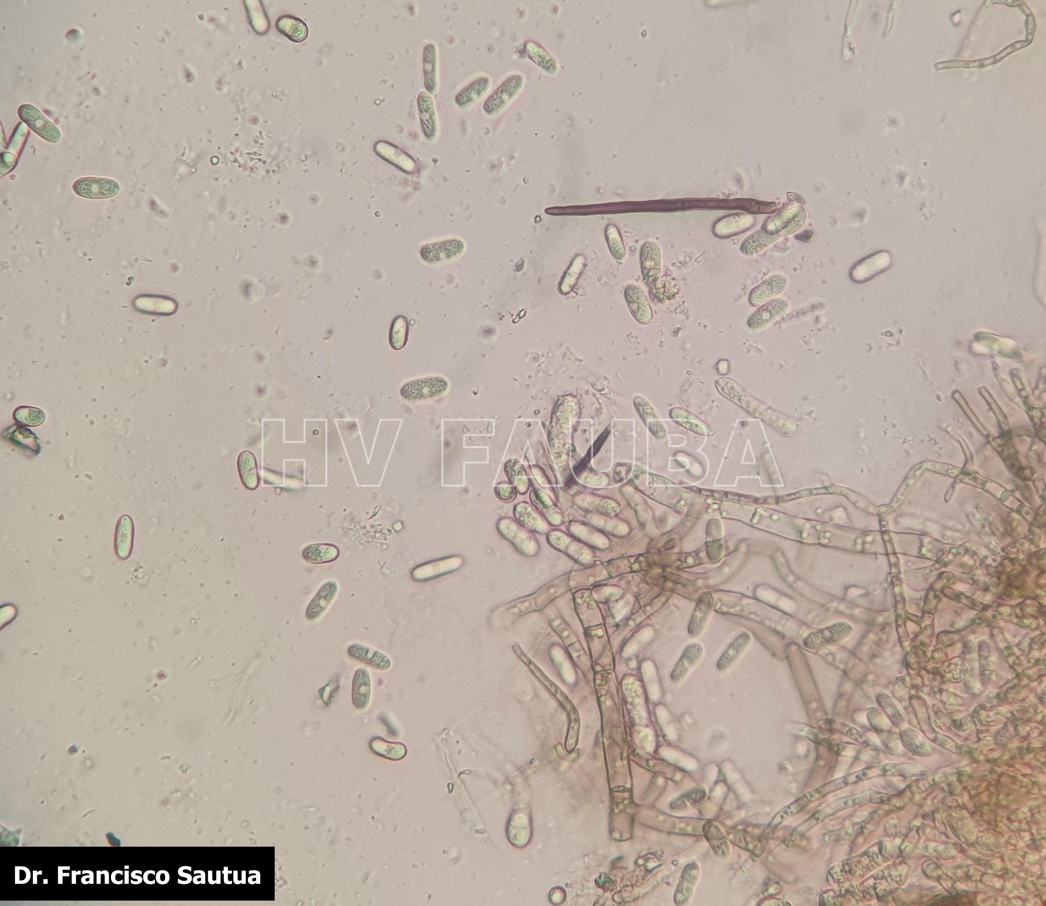Conidios de Colletotrichum spp. saliendo a partir de acérvulas sobre tallo de soja. Autor: Dr. Francisco Sautua
