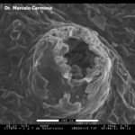 Micrografía electrónica de barrido (SEM, scanning electron microscopy) de Uredosoro de Phakopsora pachyrhizi en hoja de soja