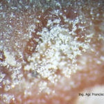 09 Conidios sobre conidióforos libres de Botrytis cinerea