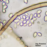 13 Conidios y conidióforos de Botrytis cinerea aislado de frutilla.