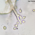 15 Conidios y conidióforos de Botrytis cinerea aislado de frutilla.