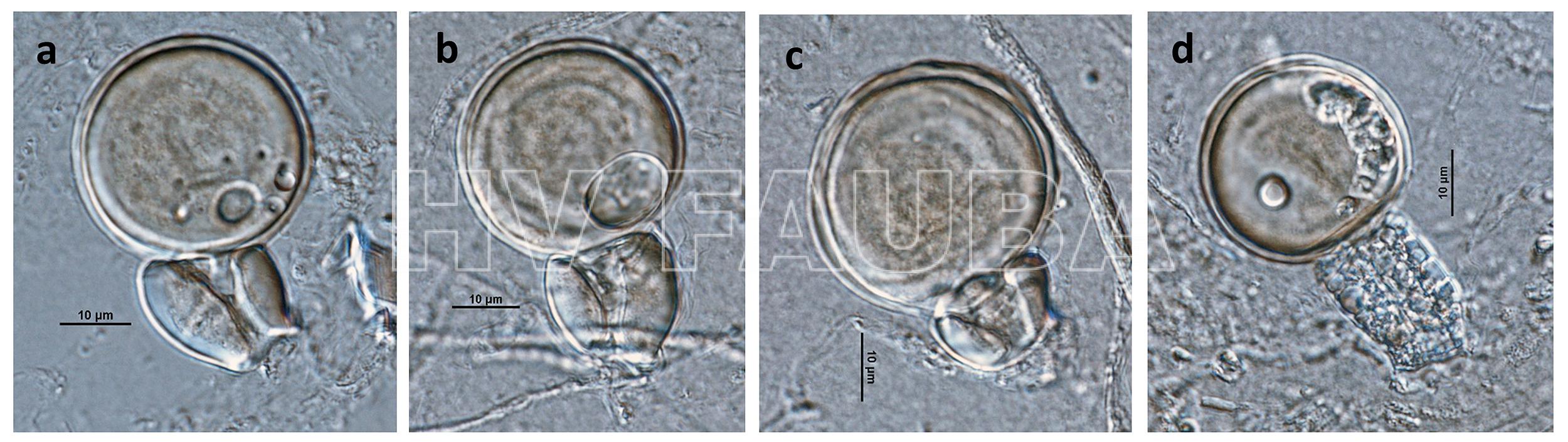 Phytophthora infestans (fase sexual heterotálica A1 x A2): (a – d) oogonio de paredes lisas con anteridios anfiginosos y oosporas pleróticas. Autor: Gloria Abad USDA-APHIS-PPQ.
