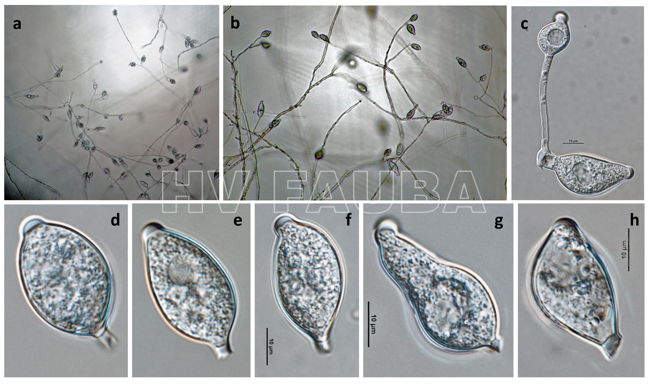 Phytophthora infestans (fase asexual): (a, b) esporangios en esporangióforos; (c) germinación externa de esporangio; (d – h) esporangios papilados con pedicelos cortos y caducos. Autor: Gloria Abad, USDA-APHIS.