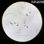 09 Micelio y basidiosporas de Thecaphora frezii. Autores: Ing. MSc. Juan Paredes y Lic. MSc. Ignacio Cazón.
