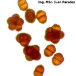 11 Teliosporas de Thecaphora frezii. Autores: Lic. MSc. Ignacio Cazón e Ing. MSc. Juan Paredes