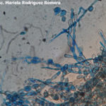 11 Conidios de Monilia spp aislada de durazno. Autor: Ing. MSc. Mariela Rodriguez Romera.