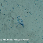 12 Conidios de Monilia spp aislada de durazno. Autor: Ing. MSc. Mariela Rodriguez Romera.