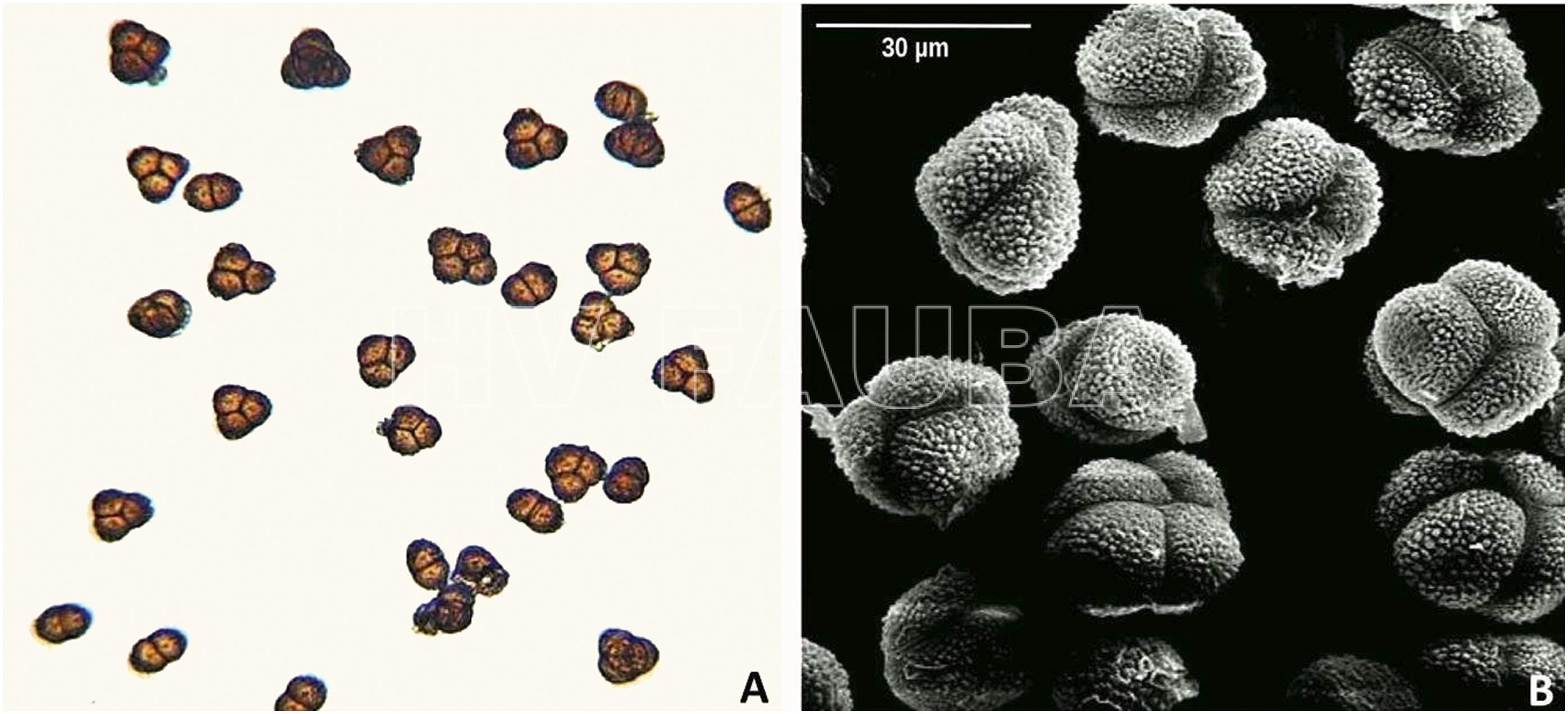 Teliosporas de Thecaphora frezii. A, Teliosporas observadas al microscopio óptico a 10×. B, Micrografías electrónicas de barrido de teliosporas multicelulares. Autores: Rago et al., 2017.