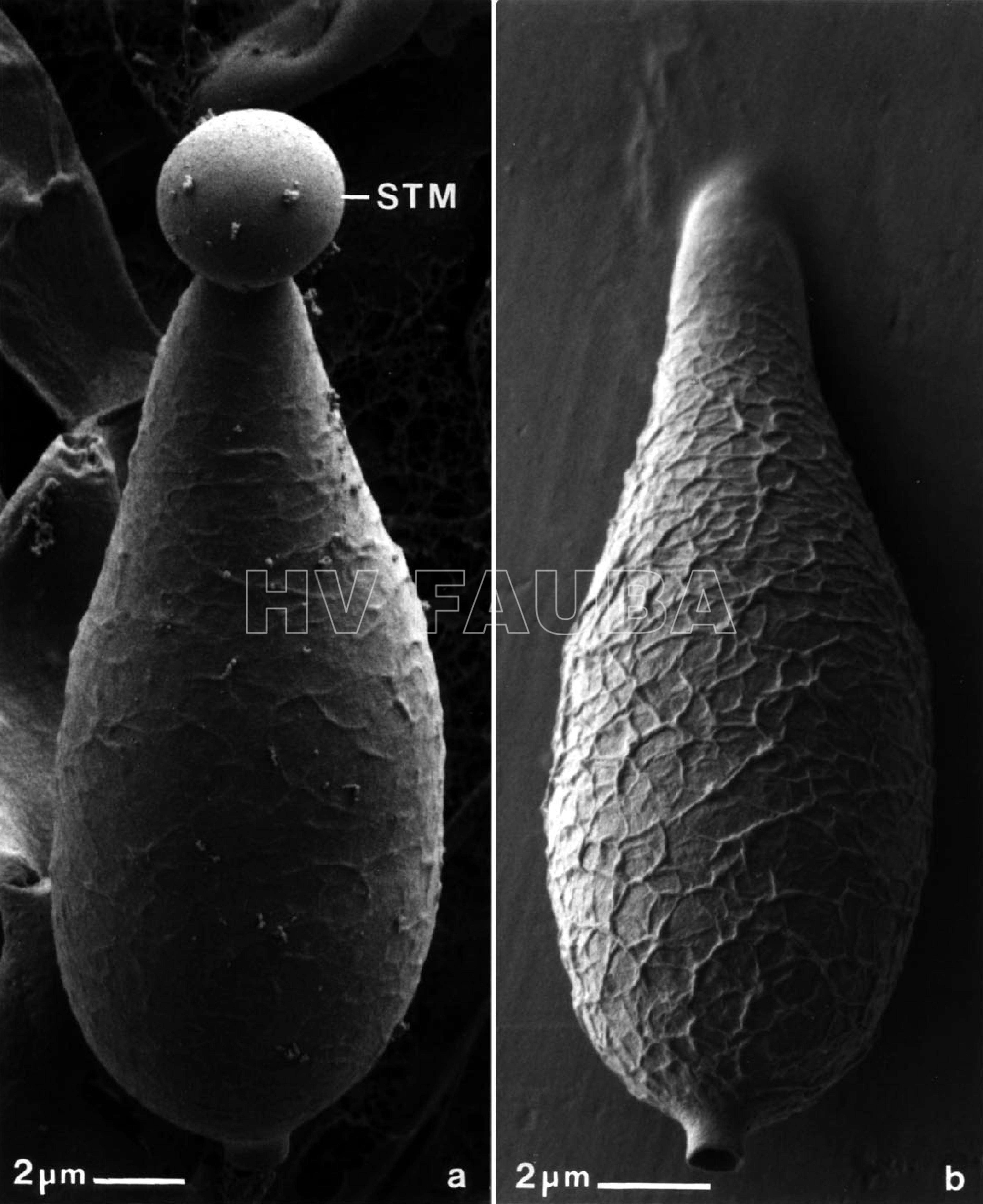 Micrografías electrónicas de barrido criogénico de conidios de M. grisea. (a) Conidio soportado en el conidióforo, que exhibe una gota apical de mucílago adhesivo en la punta de la espora (STM). (b) La fijación de conidio por medio de STM resultó de tocar la superficie del cubreobjetos de plástico a la colonia esporulante. Nótese la ornamentación reticulada única en la superficie de los conidios. Autor: Howard y Valent, 1996.