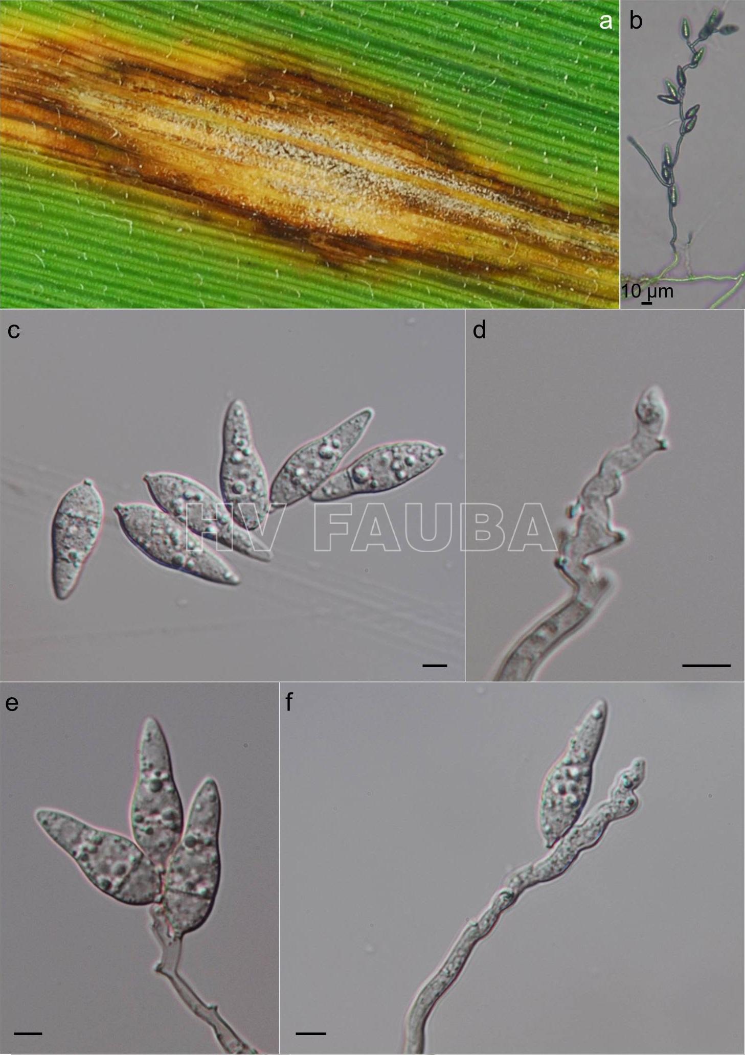 (A) Esporulación de Pyricularia oryzae en lesión foliar. (B)  Esporulación en WA. (C)  Conidios. (D – F) Conidióforos y conidios (barras = 5 μm). Autor: Database for Rice Seed-borne Fungi