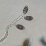 Formación de conidióforo sympodial y conidios de Wilsonomyces carpophilus en agar papa  glucosado, en condiciones de oscuridad  (bar = 10 uM)