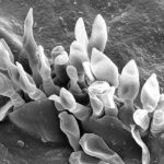 Micrografía electrónica de barrido (SEM) de conidios flamiformes de Spilocaea pomi a partir de conidióforos cortos que irrumpen a través de la cutícula. Autor: Charles Krause.