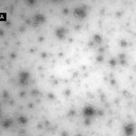 09 SEM de partícula del virus BYMV. Autor: CIAP-INTA