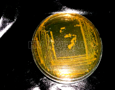 Colonias bacterianas de Clavibacter michiganensis subsp. nebraskensis en medio KB. Autor: Ayala Labarrios et al 2004.
