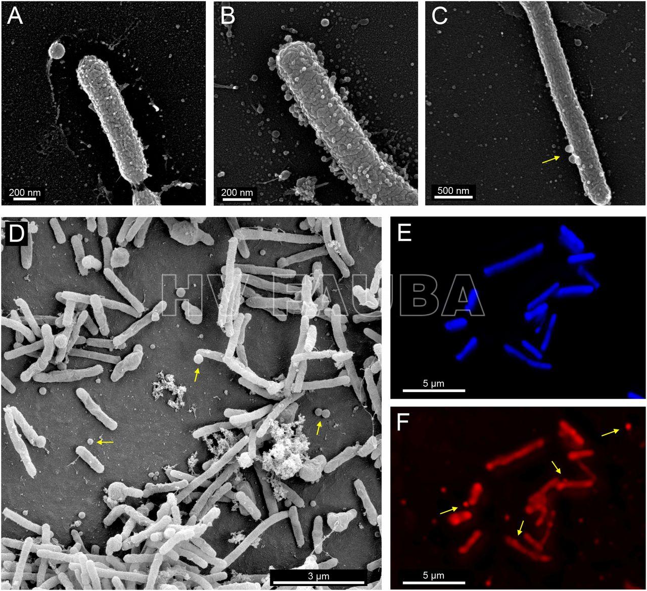 Microscopía electrónica de barrido de Xylella fastidiosa (Ionescu et al., 2014)