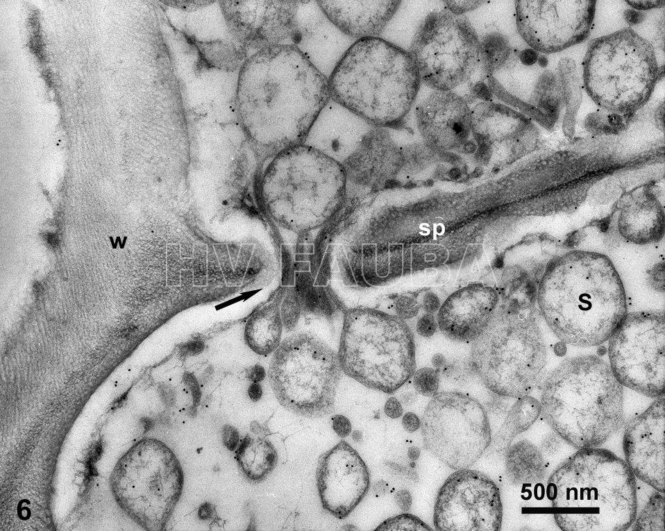 Marcado de S. kunkelii (CSS) con inmuno-oro en tubos cribosos y otras células del floema del tejido de la raíz de maíz infectado. En esta imagen, CSS parece estar cruzando un poro de tamiz en la placa de tamiz de floema (tubo criboso). Autor: Ammar & Hogenhout, 2005;