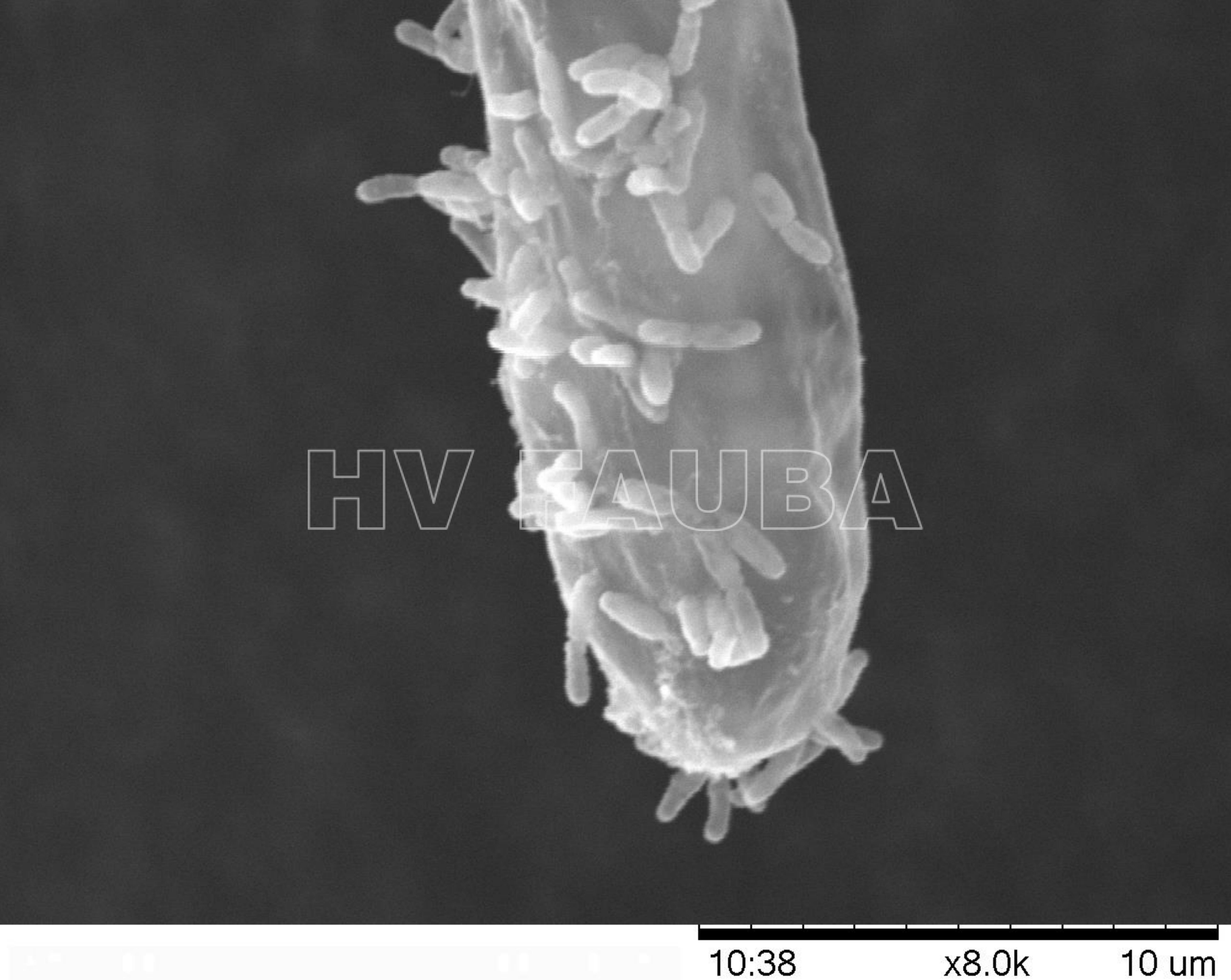 Imagen de microscopio electrónico de barrido de Agrobacterium tumefaciens C58 unida a Arabidopsis thaliana Columbia-0. La imagen se observó utilizando un microscopio de exploración de mesa Hitachi TM -1000 con un aumento de 10,000x. Autor: Petrovicheva et al., 2017