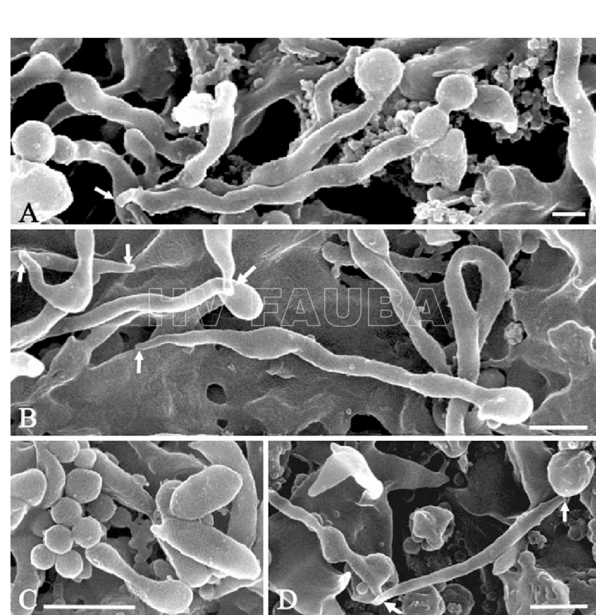 Preparaciones de microscopía electrónica de barrido (SEM, del Inglés: Scanning electron microscopy) de (A)  Spiroplasma kunkelii, (B)  Spiroplasma melliferum, (C) Spiroplasma citri y (D)  Spiroplasma floricola,   cultivadas. Observese las estructuras de la punta (flechas), las partes globulares de la hélice (A, B), un grupo de yemas (C) y las formas irregulares (C, D). Barras de escala: 500 nm. Autor:Ammar et al., 2004
