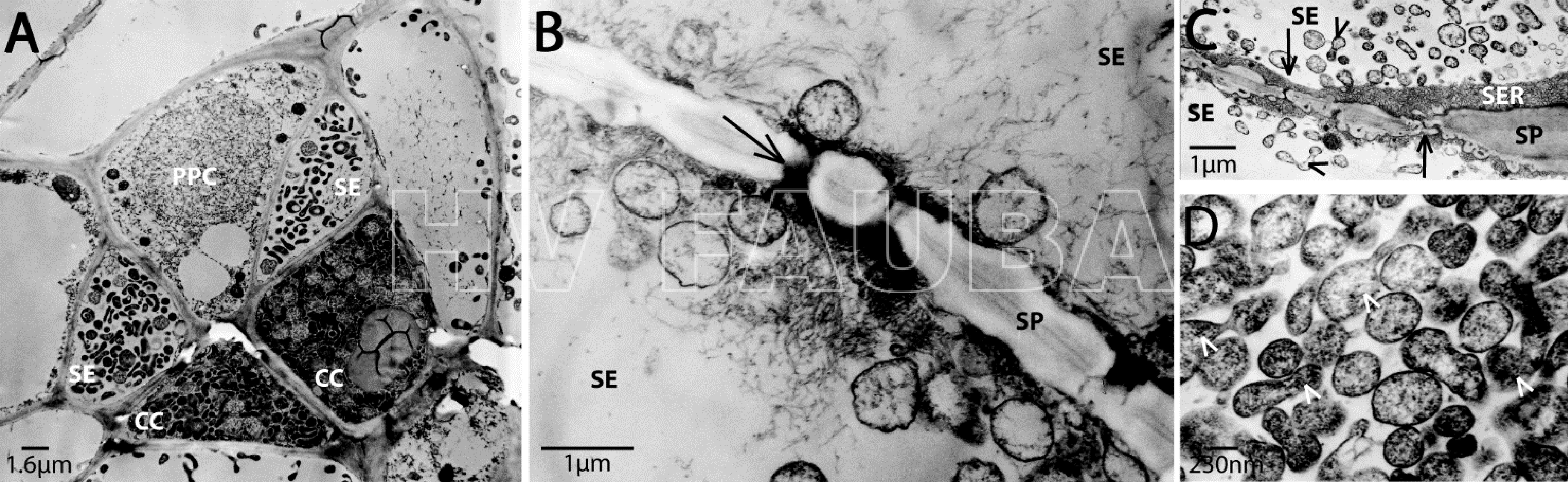 Micrografías electrónicas de transmisión de Candidatus P. mali infectando plantas de Cuscuta odorata. La descripción general de las células del floema (A) muestra una infección de tubos cribosos (SE), células compañeras (CC) y células del parénquima del floema (PPC) con fitoplasmas. Un mayor aumento o zoom (B, C) ilustra la acumulación de fitoplasmas en los tubos cribosos y los fitoplasmas densamente empaquetados, algunos son brotes (puntas de flecha) (D). Los poros del tamiz (tubo criboso) están marcados con flechas. SP (sieve plate), placa de tamiz; SER (sieve element reticulum), retículo de elemento tamiz. Autor: Zimmermann et al., 2015
