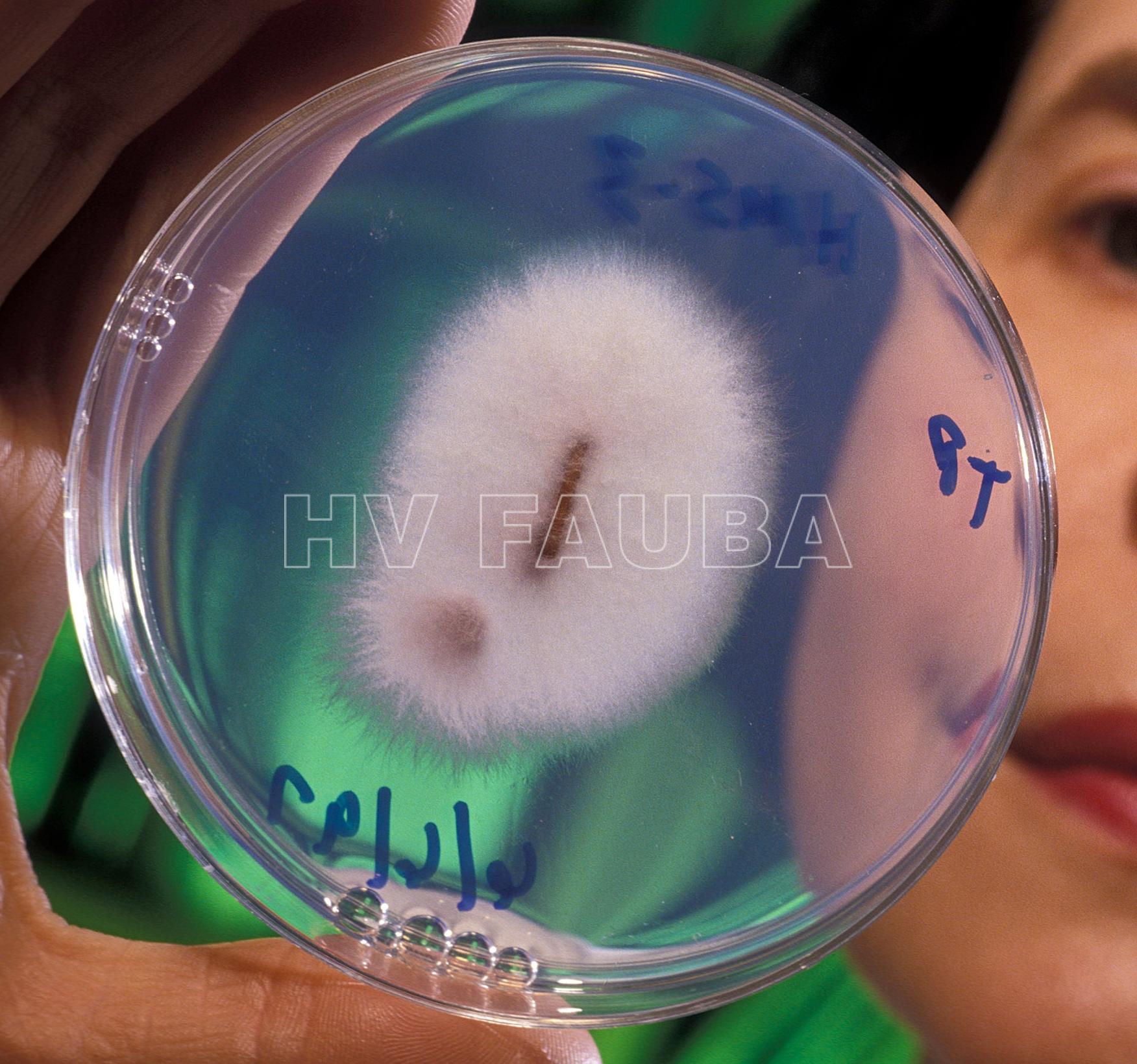 Cepa patógena de Fusarium oxysporum que causa marchitez en garbanzo. Autor: Keith Weller, USDA-ARS - USDA