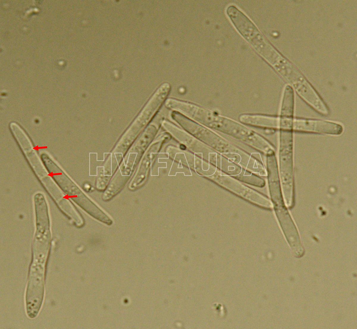 Conidios de Parastagonospora nodorum. Las flechas blancas indican tres tabiques de un conidio a 1000 ×. Autor:: U. Adhikari, publicado en Mehra et al., 2009.