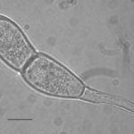 Las teliosporas son hialinas, cilíndricas, fusiformes y claviformes oblongas a oblongas (rara vez elípticas) con una pared celular lisa de color amarillo pálido (1–2 µm de espesor, 3–10 µm de espesor en el ápice). Predominantemente, las teliosporas están ligeramente constreñidas en un solo tabique, raramente biseptadas, 32–45 × 12–18 µm (excluyendo el pedicelo). El pedicelo es hialino, persistente y de hasta 45 µm de largo. Autor: EPPO Global Database