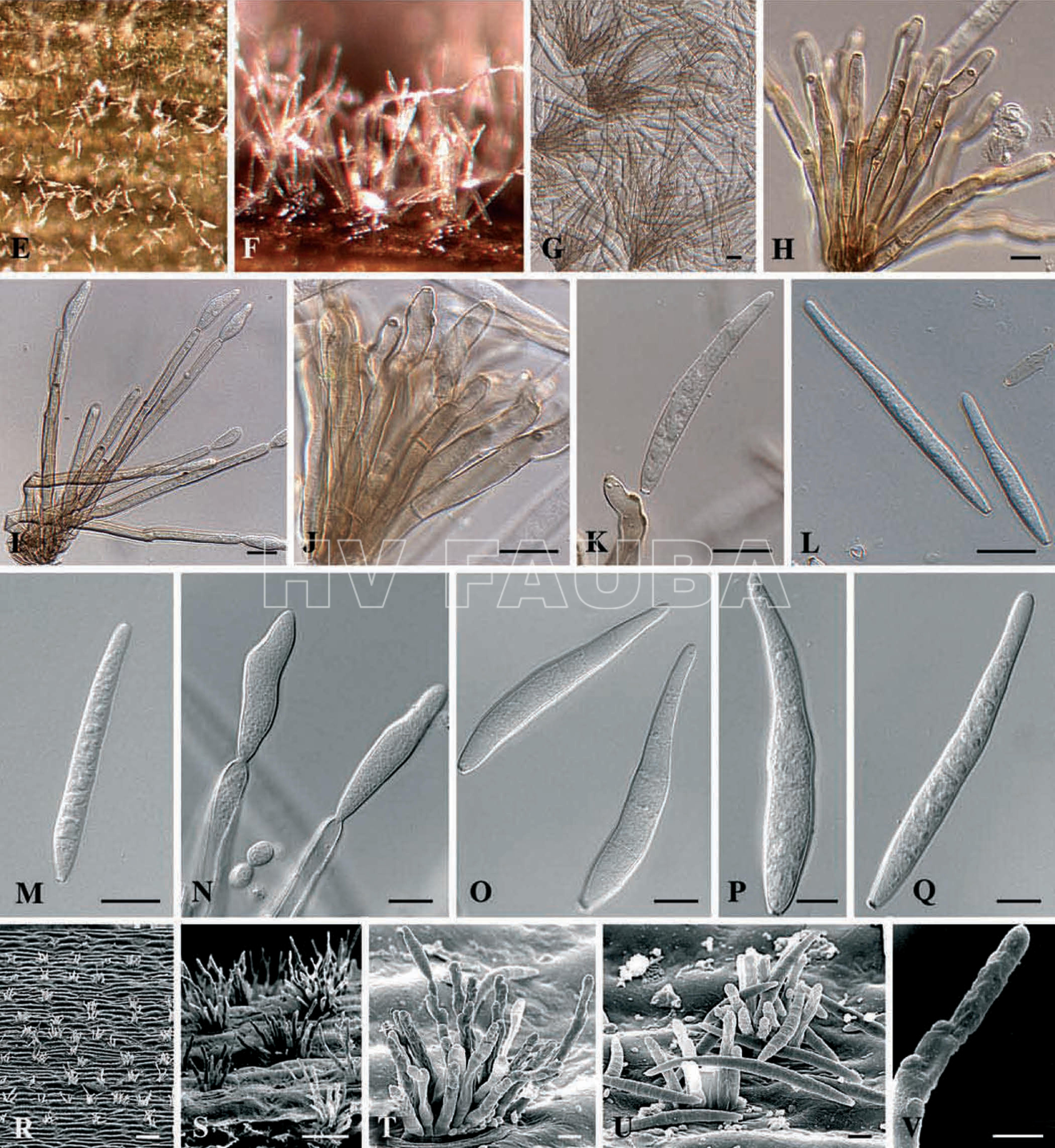 Cercospora zeina. (E - G) Fascículos de conidióforos en la superficie de la hoja. (H – J) Conidióforos. (K, N) Células conidiógenas que dan lugar a conidios. (L – M, O – Q) Conidios. (R – U) Micrografías electrónicas de barrido de conidióforos y conidios. (V) Célula conidiógena que muestra loci engrosados. Barras de escala: G – Q = 10 µm, R = 100 µm, S = 50 µm, T – U = 8 µm, V = 5 µm. Autor: Crous et al., 2006.