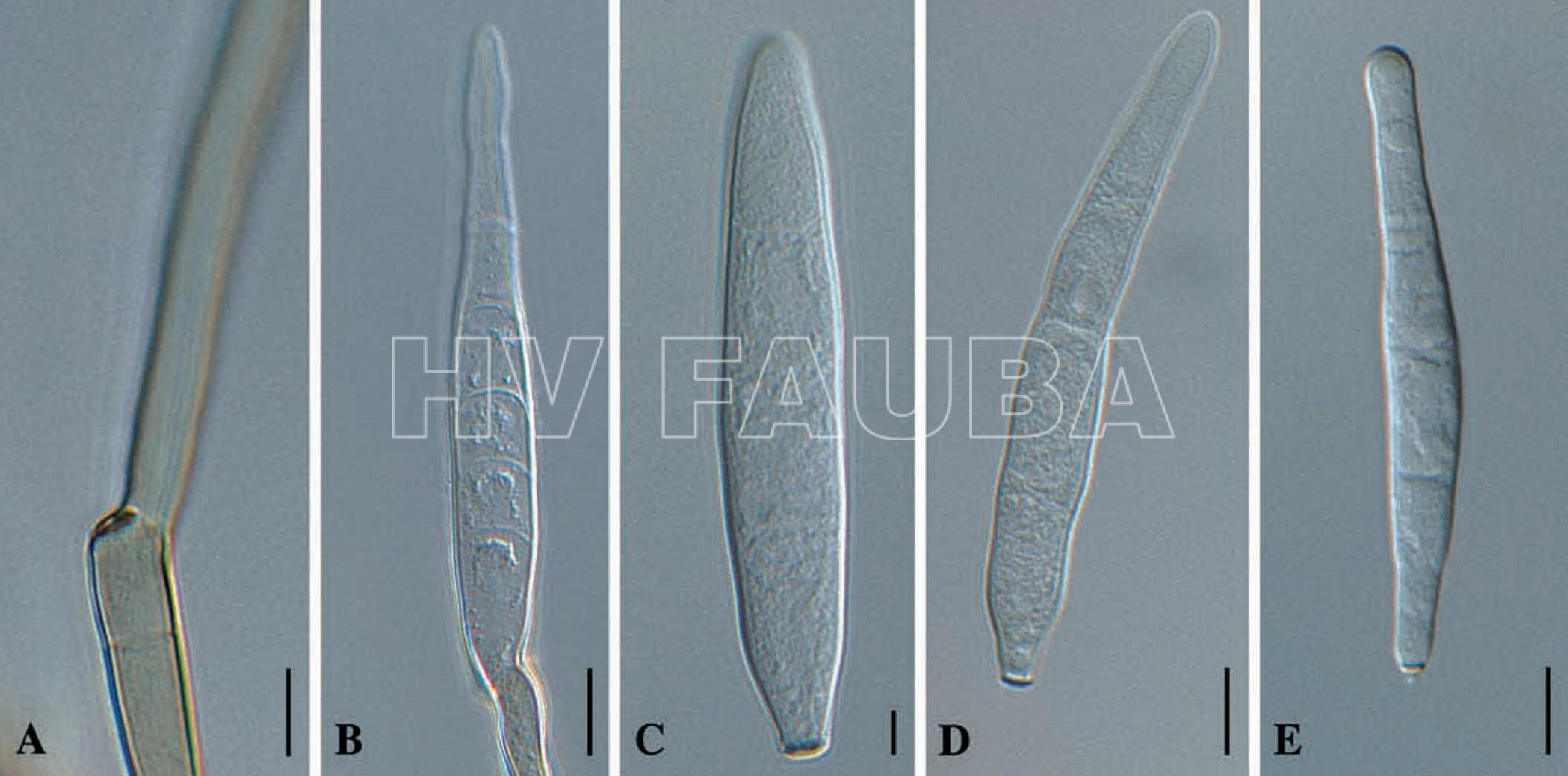 Cercospora zeae-maydis. (A) Conidióforo con locus conidiógeno refractivo oscurecido. (B)  Germinación de conidio. (C – E) Conidios in vitro. Barras = 10 µm. Autor: Crous et al., 2006.