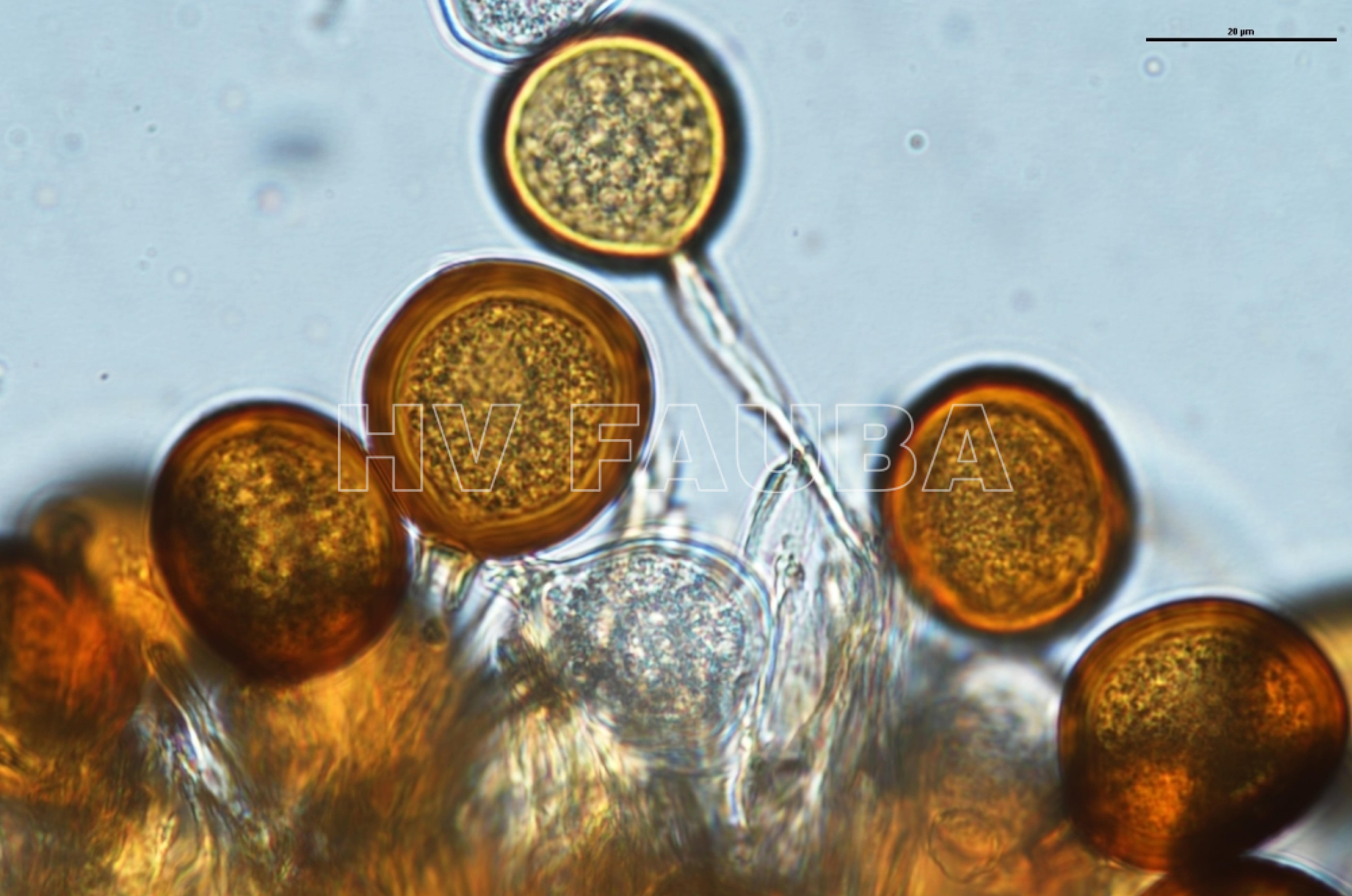 Teliosporas de Uromyces aloes. 
Autor: Bily et al 2021