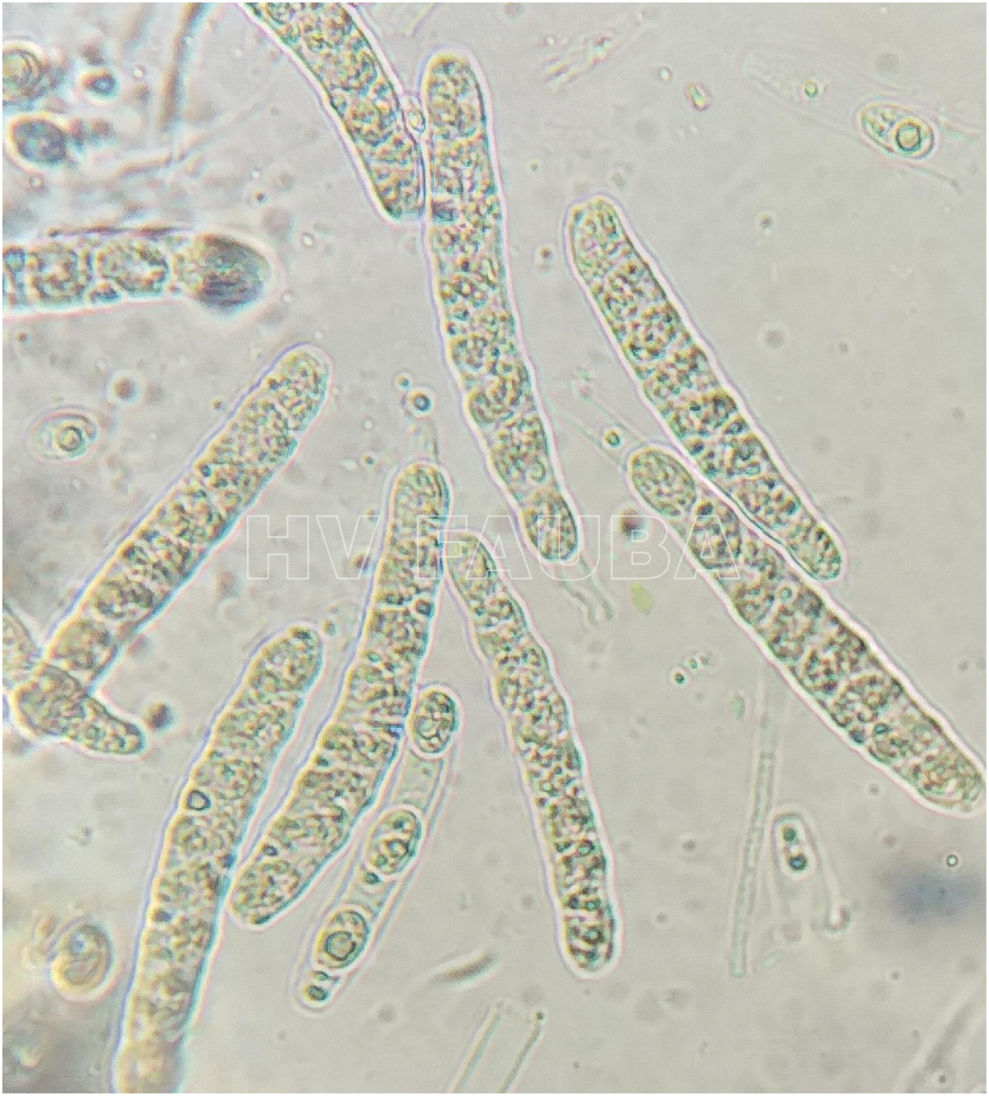 Esporas sexuales de Phyllachora maydis (ascosporas). Autor: Valle-Torres et al., 2020.