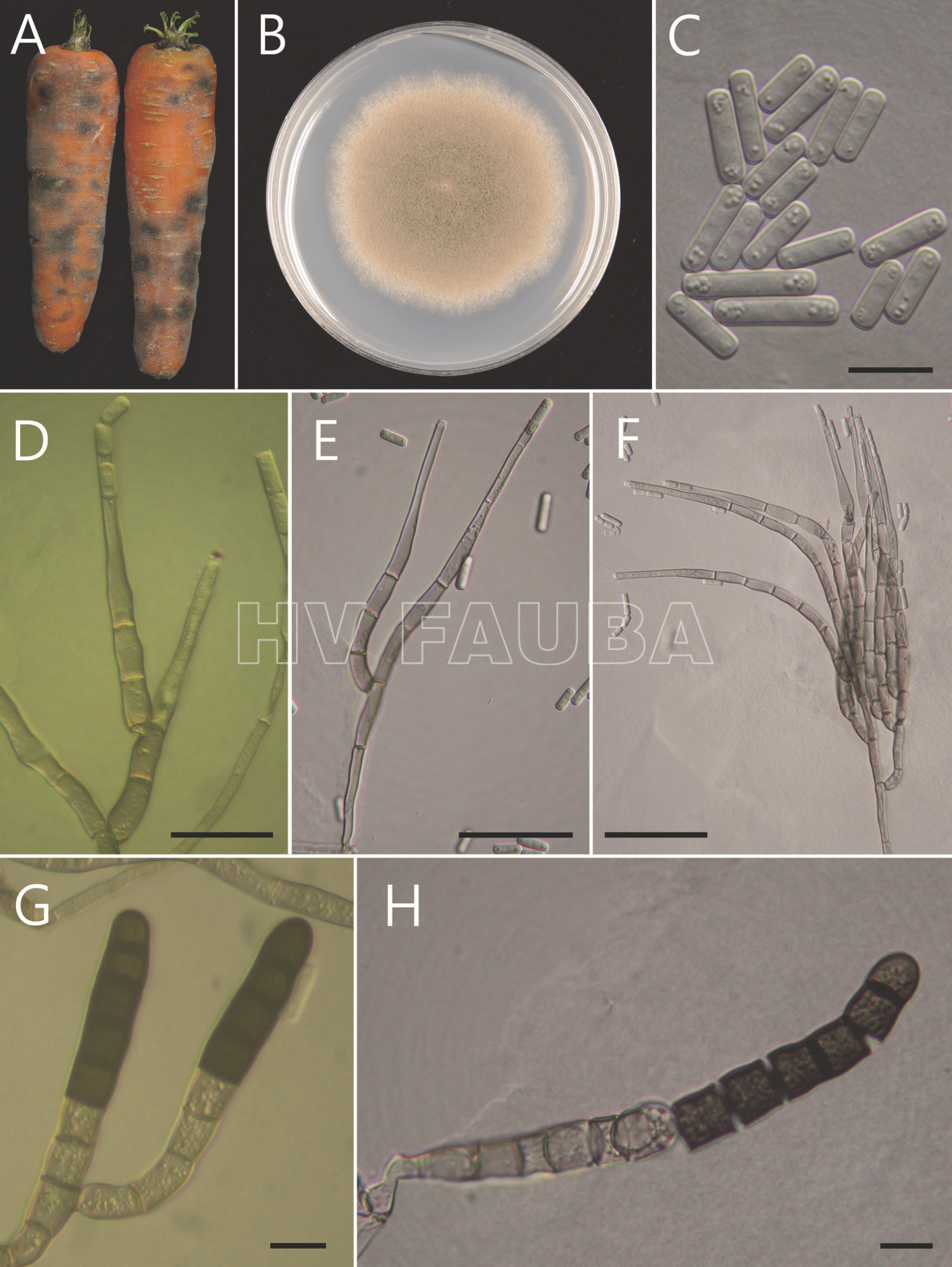 Berkeleyomyces basicola. (A) Síntoma en zanahorias. (B) Colonia en PDA. (C) Conidios. (D-F) Conidióforos, células conidiógenas fialídicas y conidios. (G) Clamidosporas. (H) Fragmentación de clamidosporas. Barras: C, G y H = 10 μm. D-F = 30 µm. Autor: Huang y Chen, 2010.