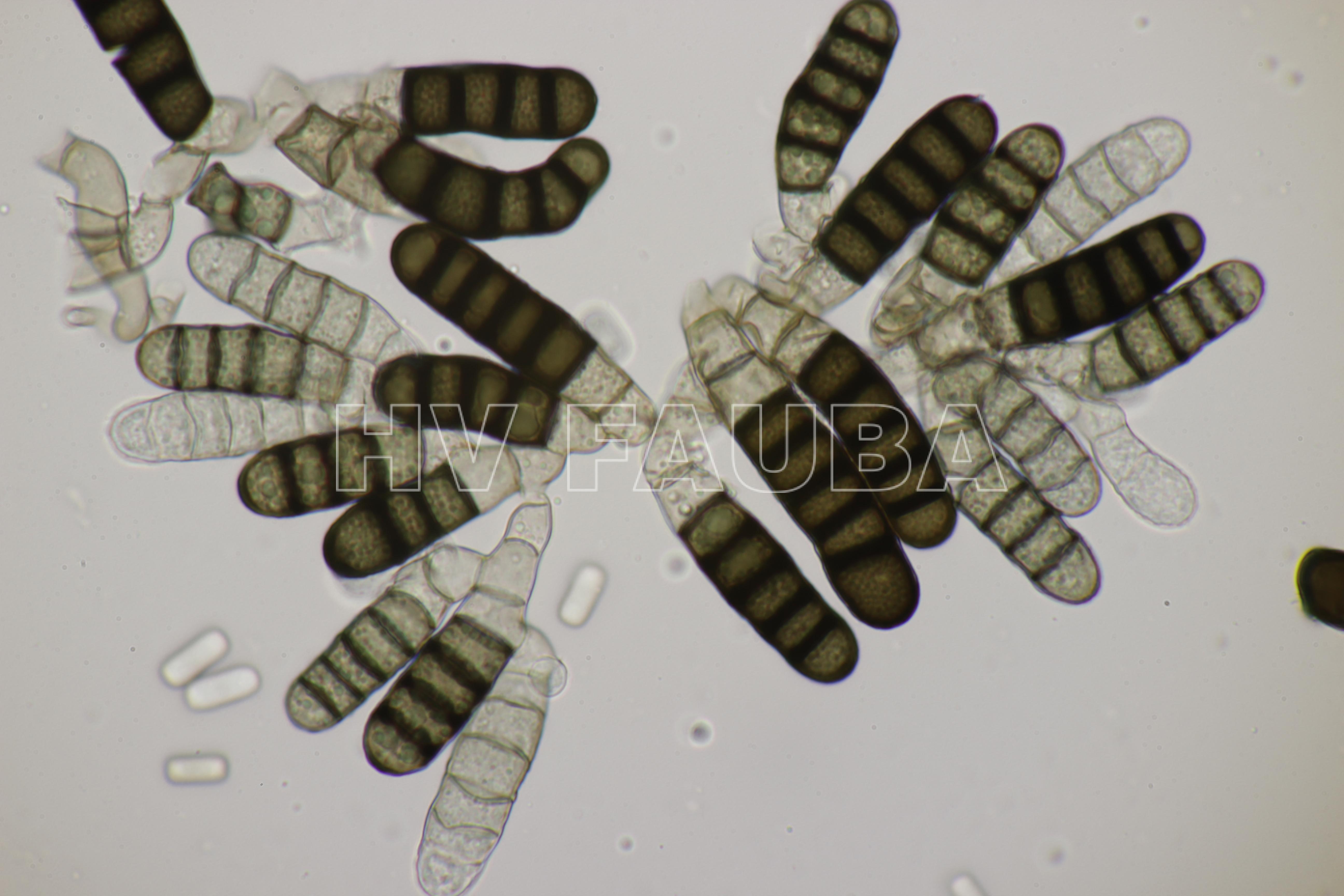 Clamidosporas de Berkeleyomyces basicola. Autor: Björn Sothmann