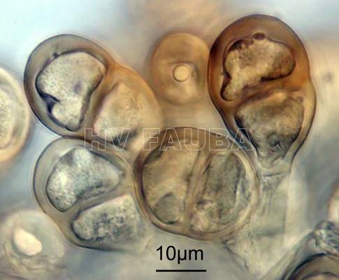 Teliosporas de Puccinia pittieriana (x1000). Autor: USDA-ARS/Systematic Mycology & Microbiology Laboratory